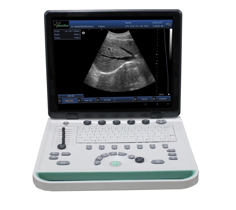 PC based 3D Ultrasound Machine SS-9 Laptop Ultrasound scanner